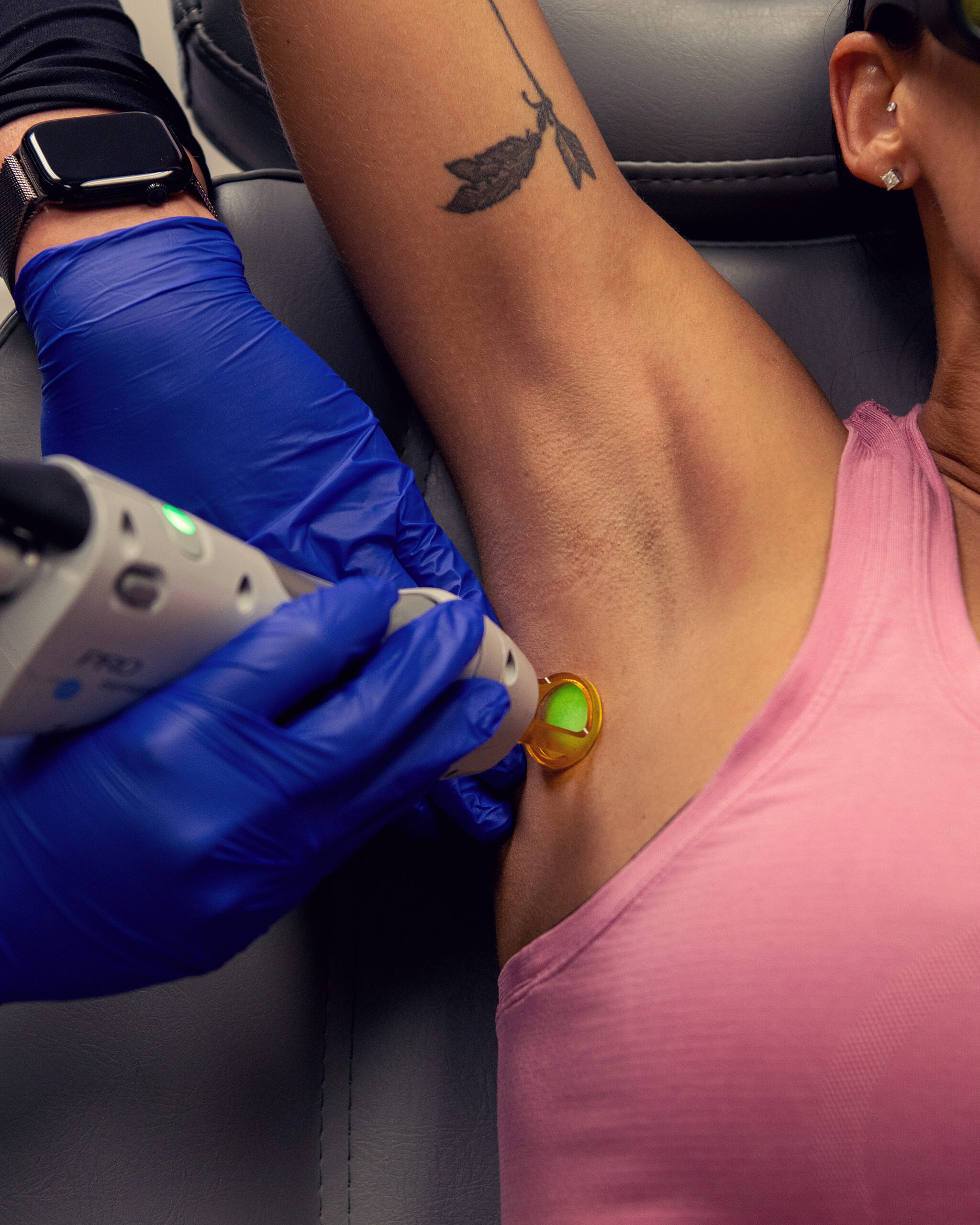 Smooth legs after laser hair removal treatment at Adorne Medical Aesthetics in Lewis County.